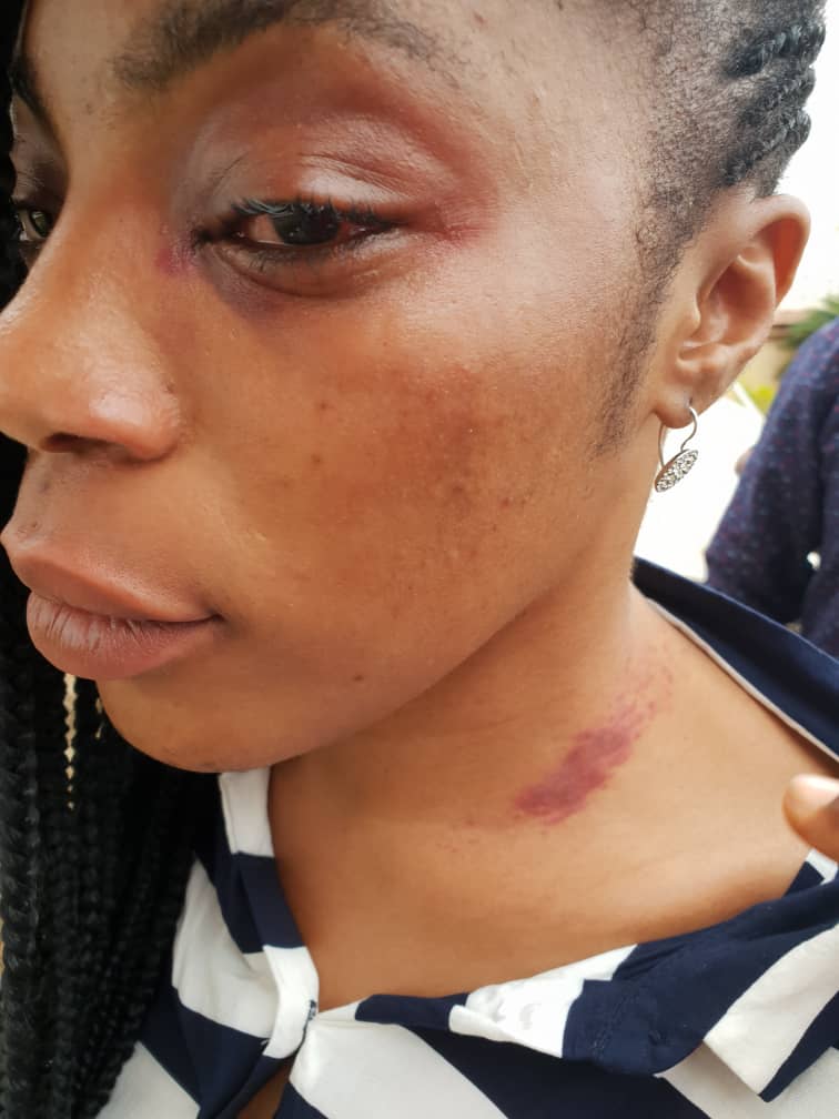 Barrister Aida Ogwuche, accused her opponent of unleashing thugs on her