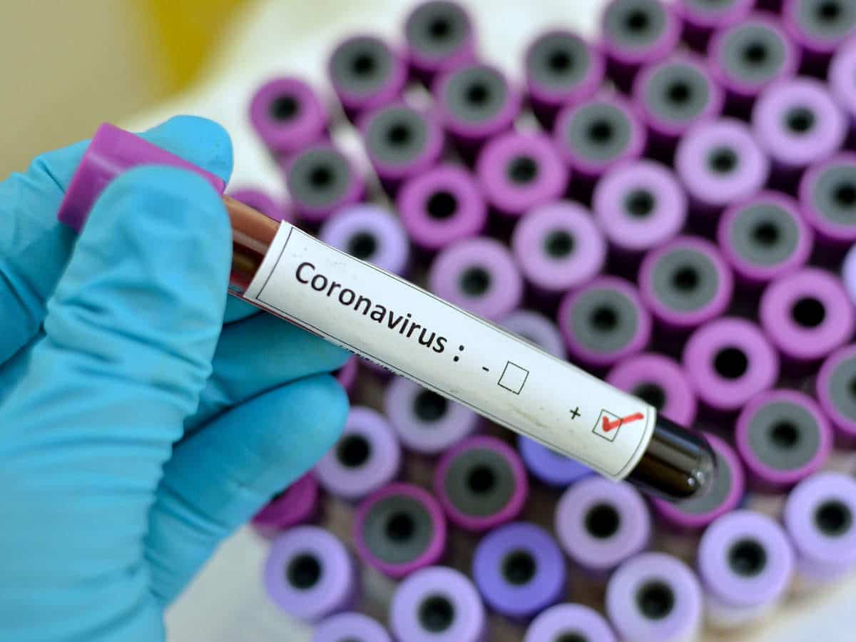 breaking:-nigeria-confirms-20-new-cases-of-coronavirus-as-figure-hits-131